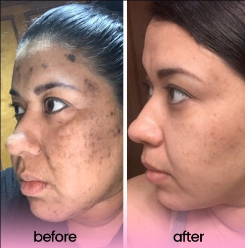 Turmeric Acid Cleaning Pads