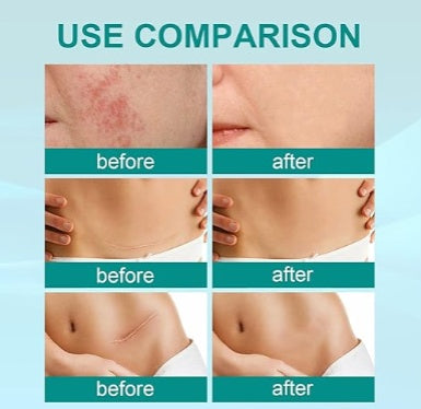 South Moon - Scar Spray